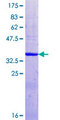 FKRP Protein - 12.5% SDS-PAGE Stained with Coomassie Blue.