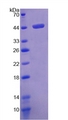 FMOD / Fibromodulin Protein - Recombinant Fibromodulin By SDS-PAGE