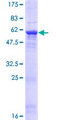 FN3KL / FN3KRP Protein - 12.5% SDS-PAGE of human FN3KRP stained with Coomassie Blue