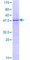 FNDC4 Protein - 12.5% SDS-PAGE of human FNDC4 stained with Coomassie Blue