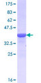FOXD4L1 / FOXD5 Protein - 12.5% SDS-PAGE Stained with Coomassie Blue.