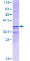 FOXD4L4 Protein - 12.5% SDS-PAGE Stained with Coomassie Blue.