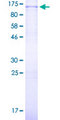 FOXM1 Protein - 12.5% SDS-PAGE of human FOXM1 stained with Coomassie Blue