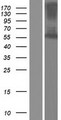 FSCN2 / Retinal Fascin Protein - Western validation with an anti-DDK antibody * L: Control HEK293 lysate R: Over-expression lysate