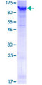 FSIP1 Protein - 12.5% SDS-PAGE of human FSIP1 stained with Coomassie Blue