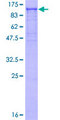 FURIN Protein - 12.5% SDS-PAGE of human FURIN stained with Coomassie Blue