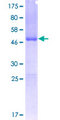 FXN / Frataxin Protein - 12.5% SDS-PAGE of human FXN stained with Coomassie Blue