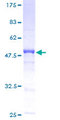 GAJ / MND1 Protein - 12.5% SDS-PAGE of human GAJ stained with Coomassie Blue