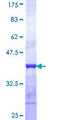 GALK1 / GK1 Protein - 12.5% SDS-PAGE Stained with Coomassie Blue.