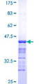 GALNT1 Protein - 12.5% SDS-PAGE Stained with Coomassie Blue.