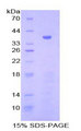 Gamma-Lipotropic Hormone Protein - Recombinant Gamma-Lipotropic Hormone By SDS-PAGE