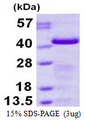 GAP43 Protein