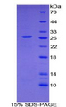 GAS2 Protein - Recombinant Growth Arrest Specific Protein 2 By SDS-PAGE
