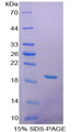 GBA / Glucosidase Beta Acid Protein - Recombinant Glucosidase Beta, Acid By SDS-PAGE