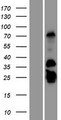 GCAP2 / GUCA1B Protein - Western validation with an anti-DDK antibody * L: Control HEK293 lysate R: Over-expression lysate