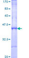 GCAP2 / GUCA1B Protein - 12.5% SDS-PAGE Stained with Coomassie Blue.