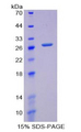 GCLM Protein - Recombinant Glutamate Cysteine Ligase, Modifier Subunit By SDS-PAGE