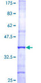 GCNT2 Protein - 12.5% SDS-PAGE Stained with Coomassie Blue.