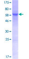 GDAP1L1 Protein - 12.5% SDS-PAGE of human GDAP1L1 stained with Coomassie Blue
