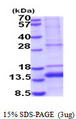 GDF11 / GDF-11 Protein