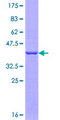 GEMIN5 Protein - 12.5% SDS-PAGE Stained with Coomassie Blue.