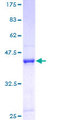 GEMIN6 / Gemin-6 Protein - 12.5% SDS-PAGE of human GEMIN6 stained with Coomassie Blue