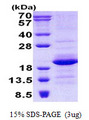 GEMIN6 / Gemin-6 Protein