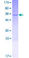 GEMIN8 Protein - 12.5% SDS-PAGE of human GEMIN8 stained with Coomassie Blue