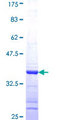Gephyrin Protein - 12.5% SDS-PAGE Stained with Coomassie Blue.