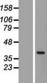 GET4 Protein - Western validation with an anti-DDK antibody * L: Control HEK293 lysate R: Over-expression lysate