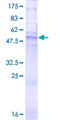 GJB1 / CX32 / Connexin 32 Protein - 12.5% SDS-PAGE of human GJB1 stained with Coomassie Blue