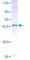 GJB5 / CX30.1 / Connexin 31.1 Protein - 12.5% SDS-PAGE of human GJB5 stained with Coomassie Blue