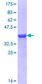 GLDC Protein - 12.5% SDS-PAGE Stained with Coomassie Blue.