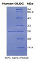 GLDC Protein - Recombinant Glycine Dehydrogenase By SDS-PAGE