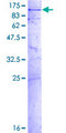 GLE1 Protein - 12.5% SDS-PAGE of human GLE1 stained with Coomassie Blue