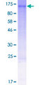 GLTSCR1L / KIAA0240 Protein - 12.5% SDS-PAGE of human KIAA0240 stained with Coomassie Blue