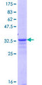 Glutathione S-transferase P  Protein - 12.5% SDS-PAGE Stained with Coomassie Blue.