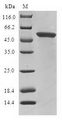 GLYATL1 Protein - (Tris-Glycine gel) Discontinuous SDS-PAGE (reduced) with 5% enrichment gel and 15% separation gel.