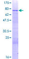 GLYR1 Protein - 12.5% SDS-PAGE of human N-PAC stained with Coomassie Blue