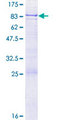 GMCL1 Protein - 12.5% SDS-PAGE of human GMCL1 stained with Coomassie Blue
