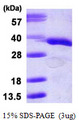 GNB2L1 / RACK1 Protein
