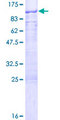 GNL1 Protein - 12.5% SDS-PAGE of human GNL1 stained with Coomassie Blue