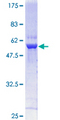 GNPDA1 Protein - 12.5% SDS-PAGE of human GNPDA1 stained with Coomassie Blue