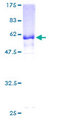 GNPTG Protein - 12.5% SDS-PAGE of human GNPTG stained with Coomassie Blue