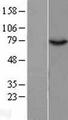 GPAT2 Protein - Western validation with an anti-DDK antibody * L: Control HEK293 lysate R: Over-expression lysate