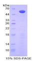 GPC3 / Glypican 3 Protein - Recombinant Glypican 3 By SDS-PAGE
