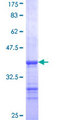 GPI3 / PIGA Protein - 12.5% SDS-PAGE Stained with Coomassie Blue.