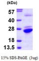 Gpnat1 / GNPNAT1 Protein