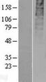 GPR55 Protein - Western validation with an anti-DDK antibody * L: Control HEK293 lysate R: Over-expression lysate