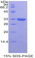 GRAP2 / GRID Protein - Recombinant GRB2 Related Adaptor Protein 2 By SDS-PAGE